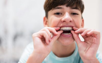 Ortodoncia Invisible en adolescentes: ventajas y consideraciones